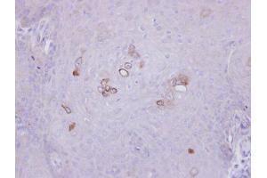 IHC-P Image Immunohistochemical analysis of paraffin-embedded Cal27 xenograft, using PHKA1, antibody at 1:500 dilution.
