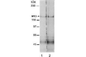 Western blot analysis of Npc1l1 in rat small intestine membrane preparations (Lane 1 : 2 ug/mL , Lane 2 : 4 ug/mL) with Npc1l1 polyclonal antibody . (NPC1L1 anticorps  (AA 500-600))