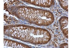 IHC-P Image Selenoprotein P antibody detects Selenoprotein P protein at cytoplasm in human colon by immunohistochemical analysis.
