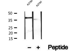 Western blot analysis of extracts of A2780 cells, using PRSS8 antibody. (PRSS8 anticorps  (Internal Region))