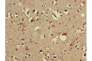 Immunohistochemistry of paraffin-embedded human brain tissue using ABIN7169274 at dilution of 1:100 (PPP2R3A anticorps  (Regulatory Subunit B))