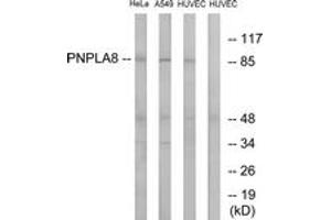 Western blot analysis of extracts from HuvEc/HeLa/A549 cells, using PNPLA8 Antibody. (PNPLA8 anticorps  (AA 691-740))