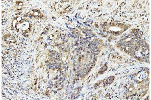 anti-Programmed Cell Death 4 (PDCD4) (AA 346-446) antibody