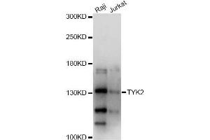 Western blot analysis of extracts of various cell lines, using TYK2 antibody (ABIN5971155) at 1/1000 dilution. (TYK2 anticorps)