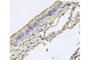 Immunohistochemistry of paraffin-embedded Human trachea using FABP12 Polyclonal Antibody at dilution of 1:100 (40x lens). (FABP12 anticorps)