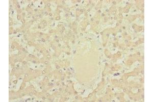Immunohistochemistry of paraffin-embedded human liver tissue using ABIN7149326 at dilution of 1:100 (DYNC2LI1 anticorps  (AA 1-352))