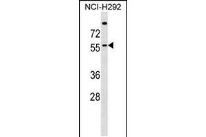 Western blot analysis in NCI-H292 cell line lysates (35ug/lane). (ZDHHC13 anticorps  (N-Term))