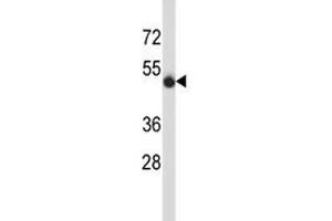 CD43 antibody western blot analysis in MDA-MB435 lysate.