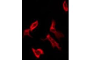 anti-Olfactory Receptor 11H1/11H2/11H12 antibody