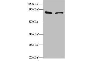 Western blot All lanes: SLC39A6 antibody at 10 μg/mL Lane 1: Hela whole cell lysate Lane 2: 293T whole cell lysate Secondary Goat polyclonal to rabbit IgG at 1/10000 dilution Predicted band size: 86, 49 kDa Observed band size: 86 kDa