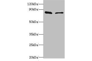 Western blot All lanes: SLC39A6 antibody at 10 μg/mL Lane 1: Hela whole cell lysate Lane 2: 293T whole cell lysate Secondary Goat polyclonal to rabbit IgG at 1/10000 dilution Predicted band size: 86, 49 kDa Observed band size: 86 kDa (SLC39A6 anticorps  (AA 170-320))