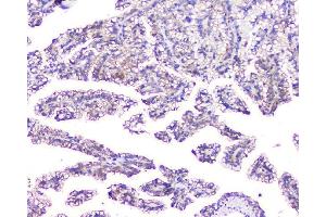 IHC analysis of EVA1A using anti-EVA1A antibody (ABIN6719564). (TMEM166 anticorps)
