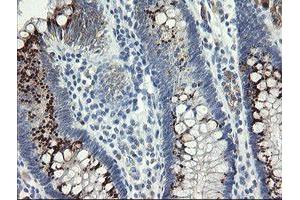 Image no. 3 for anti-Src-like-adaptor 2 (SLA2) antibody (ABIN1500948) (SLAP2 anticorps)