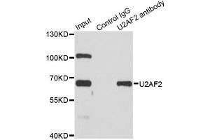 Immunoprecipitation analysis of 200ug extracts of SW620 cells using 1ug U2AF2 antibody. (U2AF2 anticorps)