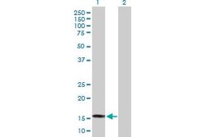 Western Blot analysis of SAT2 expression in transfected 293T cell line by SAT2 MaxPab polyclonal antibody. (SAT2 anticorps  (AA 1-170))