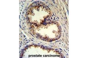 Immunohistochemistry (IHC) image for anti-Golgi phosphoprotein 3 (Coat-Protein) (GOLPH3) antibody (ABIN3003211)