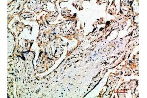 Immunohistochemical analysis of paraffin-embedded human-placenta, antibody was diluted at 1:200