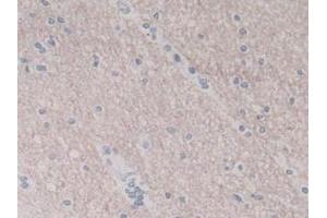 IHC-P analysis of Human Brain Tissue, with DAB staining. (IL-8 anticorps  (AA 23-101))