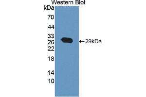Western blot analysis of the recombinant protein. (ABCA12 anticorps  (AA 1346-1577))