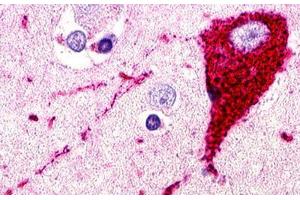 anti-G Protein-Coupled Receptor 173 (GPR173) (N-Term) antibody