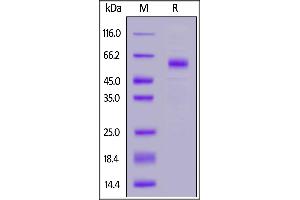 Human TREM2, Fc Tag on  under reducing (R) condition. (TREM2 Protein (AA 19-174) (Fc Tag))