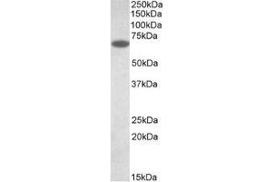 AP32138PU-N PDIA2 antibody staining of Human Pancreas lysate (35µg protein in RIPA buffer). (PDIA2 anticorps  (Internal Region))