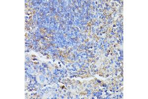 Immunohistochemistry of paraffin-embedded mouse spleen using STK24 antibody (ABIN6132364, ABIN6148602, ABIN6148603 and ABIN6214875) at dilution of 1:100 (40x lens). (STK24 anticorps  (AA 312-431))