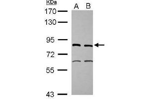 WB Image Sample (30 ug of whole cell lysate) A: IMR32 B: U87-MG 7. (ERCC2 anticorps  (Internal Region))