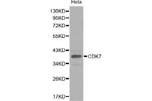 Western Blotting (WB) image for anti-Cyclin-Dependent Kinase 7 (CDK7) (AA 1-346) antibody (ABIN3022405)