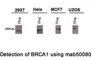 Image no. 2 for anti-Breast Cancer 1 (BRCA1) (AA 1314-1600), (AA 1314-1864) antibody (ABIN363234) (BRCA1 anticorps  (AA 1314-1600, AA 1314-1864))