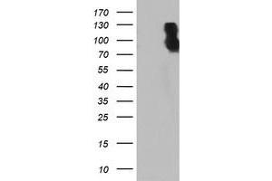 Western Blotting (WB) image for anti-Dipeptidyl-Peptidase 9 (DPP9) antibody (ABIN1497904)