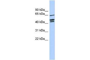 WB Suggested Anti-ZNF578 Antibody Titration:  0. (ZNF578 anticorps  (N-Term))