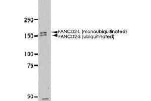 Western blot analysis of FANCD2 in HeLa whole cell extract using FANCD2 polyclonal antibody . (FANCD2 anticorps  (N-Term))