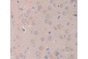 IHC-P analysis of Rat Tissue, with DAB staining. (IL1R1 anticorps  (AA 226-352))