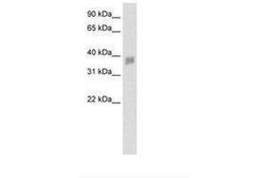 Image no. 1 for anti-Small Nuclear RNA Activating Complex, Polypeptide 3, 50kDa (SNAPC3) (N-Term) antibody (ABIN202459) (SNAPC3 anticorps  (N-Term))
