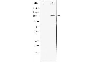Western Blotting (WB) image for anti-Dynein, Axonemal, Heavy Chain 8 (DNAH8) antibody (ABIN1845418) (ATPase anticorps)