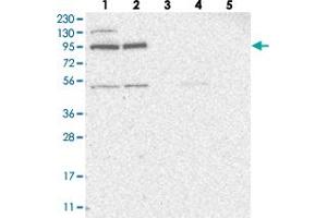 Western blot analysis of Lane 1: RT-4, Lane 2: U-251 MG, Lane 3: Human Plasma, Lane 4: Liver, Lane 5: Tonsil with ZNF341 polyclonal antibody  at 1:250-1:500 dilution. (ZNF341 anticorps)