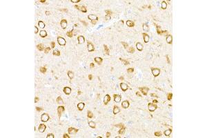 Immunohistochemistry of paraffin-embedded rat brain using USP18 Rabbit pAb (ABIN7271145) at dilution of 1:25 (40x lens). (USP18 anticorps  (AA 200-300))