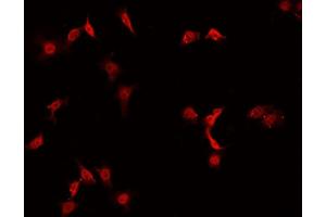 ABIN6269094 staining A-431 cells by IF/ICC.