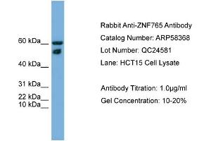 WB Suggested Anti-ZNF765  Antibody Titration: 0. (ZNF765 anticorps  (N-Term))