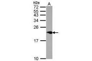 Image no. 1 for anti-Niemann-Pick Disease, Type C2 (NPC2) (AA 1-151) antibody (ABIN1499802) (NPC2 anticorps  (AA 1-151))
