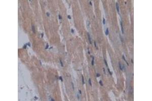 IHC-P analysis of Kidney tissue, with DAB staining. (ICK anticorps  (AA 1-284))