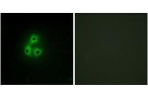 Immunofluorescence analysis of A549 cells, using CSK Antibody. (CSK anticorps  (AA 31-80))