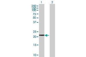 Lane 1: SIRPD transfected lysate ( 21. (SIRPD 293T Cell Transient Overexpression Lysate(Denatured))