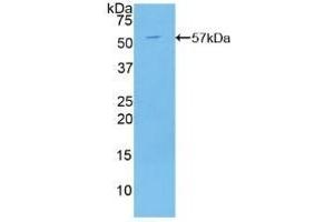 Detection of Recombinant C2CD3, Human using Polyclonal Antibody to C2 Calcium Dependent Domain Containing Protein 3 (C2CD3) (C2CD3 anticorps  (AA 1432-1647))