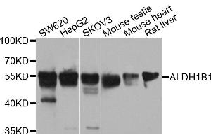 Western blot analysis of extracts of various cell lines, using ALDH1B1 antibody (ABIN5971915) at 1/1000 dilution. (ALDH1B1 anticorps)
