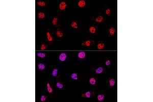 Confocal immunofluorescence analysis of L929 cells using HD Polyclonal Antibody (ABIN3020753, ABIN3020754, ABIN3020755 and ABIN6213707) at dilution of 1:200. (HDAC1 anticorps  (AA 393-482))