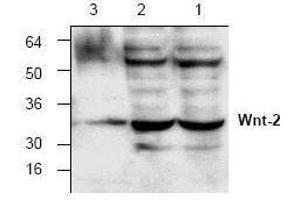 Image no. 1 for anti-Wingless-Type MMTV Integration Site Family Member 2 (WNT2) antibody (ABIN127198) (WNT2 anticorps)
