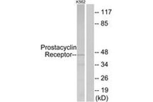 Western blot analysis of extracts from K562 cells, using Prostacyclin Receptor Antibody. (Prostacyclin Receptor anticorps  (AA 198-247))