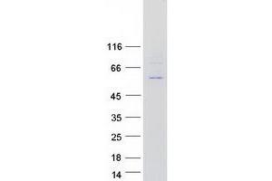 Validation with Western Blot
